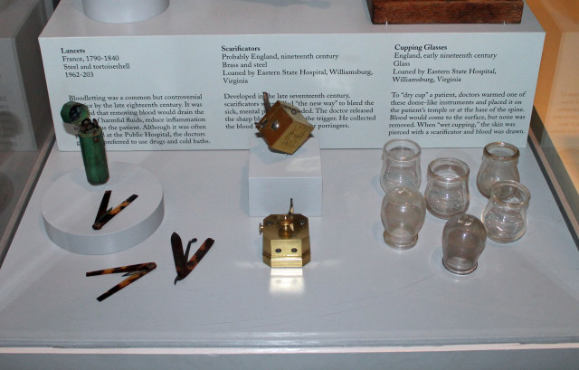 The lancers (left) were used to bleed the patient to "remove harmful fluids". Scarificators (center) were bloodletting tools with a spring-loaded mechanism that snapped the blades out through slits to pierce the skin. With cupping (right), doctors pressed the warmed glass against the patient's skin to bring blood to the surface, although it wasn't removed.