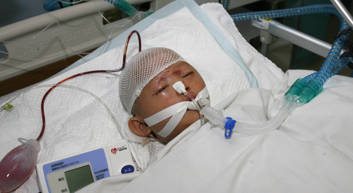 In a picture taken on October 16, 2011, two-year-old girl nicknamed Yue Yue is treated at a hospital in Guangzhou