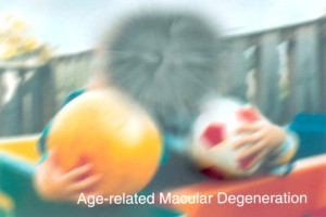 A scene as it might be viewed by a person with age-related macular degeneration. (Image: National Eye Institute, National Institutes of Health)