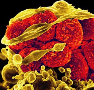 Scanning electron micrograph of methicillin-resistant Staphylococcus aureus bacteria (yellow, round items) killing and escaping from a human white cell. (NIAID)