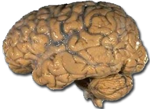 Human brain (NIH)
