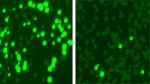 Rockefeller University researchers colonized mouse skin with a mix of bacterial cells, some resistant to the antibiotic kanamycin. They made the resistant cells glow (left) and treated the mix with an enzyme that targeted and killed off most resistant cells (right). (Marraffini Lab and Fischetti Lab/Nature Biotechnology)