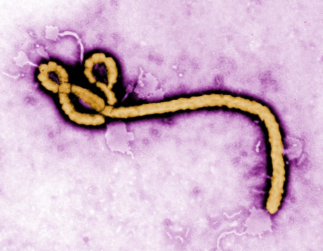 Colorized transmission electron micrograph (TEM) revealed some of the ultrastructural morphology displayed by an Ebola virus virion. (CDC/Frederick Murphy)