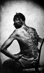 These scars on the back of a freed slave in Louisiana in 1863 bespeak one of slavery's frequent horrors.  (Wikipedia Commons)