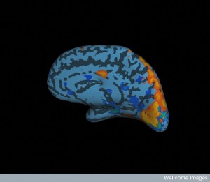 Smoothed view of brain showing visual cortex (in orange and yellow) (Photo: Mark Lythgoe & Chloe Hutton-Wellcome Images)