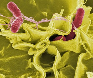  Color-enhanced scanning electron micrograph showing Salmonella typhimurium (red) invading cultured human cells. (Photo: Rocky Mountain Laboratories, NIAID, NIH)