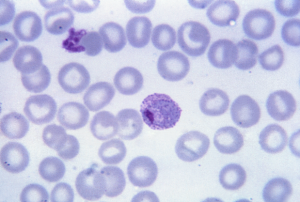 Micrograph reveals a mature Plasmodium vivax trophozoite (Photo: US Centers for Disease Control and Prevention)