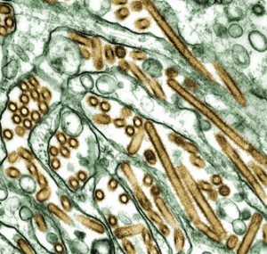 Electron micrograph provided by the U.S. Centers for Disease Control and Prevention shows the bird flu virus strain H5N1 (in gold). (Photo: AP) 