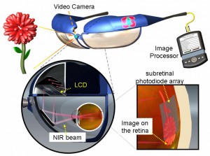 The Photovoltaic Retinal Prothesis system (Graphic: Palanker Lab at Stanford University)