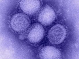 A microscopic image of the H1N1 ('swine flu') influenza virus - In 2009, the World Health Organization declared this new strain as a pandemic.