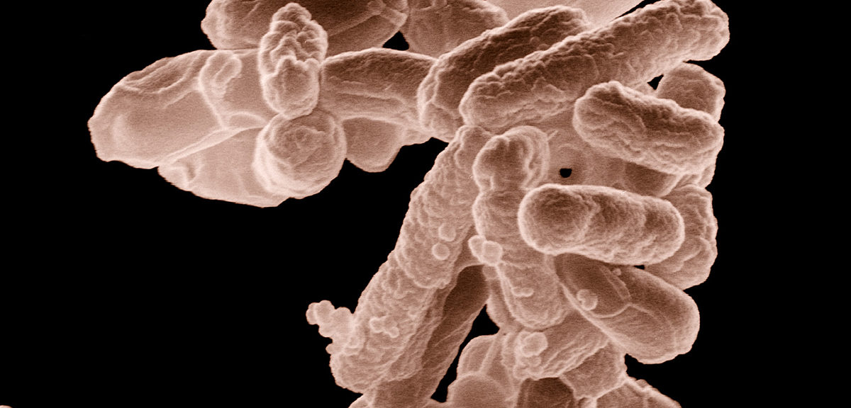 A cluster of E. coli bacteria magnified 10,000 times. (USDA)