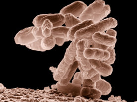 A cluster of E. coli bacteria magnified 10,000 times. (USDA)
