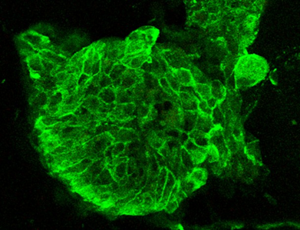 A team of engineers, from the University of Illinois at Urbana-Champaign, has developed a three-dimensional substance that will help scientists who study brain cancer since it more closely mimics conditions in the brain. The substance called hydrogel is used for growing glioma - brain cancer - cells in a laboratory. This image shows brain cancer cells that were grown in the new hydrogel. The green fluorescent dye reflects the cytoskeletons of the cells. (Brendan Harley)