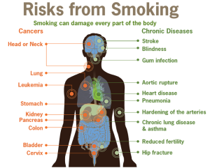 Health experts say smoking can be hazardous to your health (CDC via Wikipedia Commons)