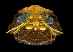 3D reconstruction of the skull the fish Romundina showing a mixture of facial structures found in both jawless and jawed vertebrates. (Vincent Dupret, Uppsala University/Nature)