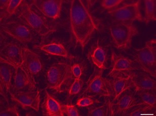 Fluorescent microscopic view of bone cancer cells (© ESA-Yassen Abbas)