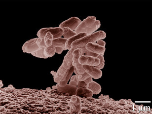 An electron micrograph of a cluster of E. coli bacteria, magnified 10,000 times. Each individual bacterium is oblong shaped (USDA)