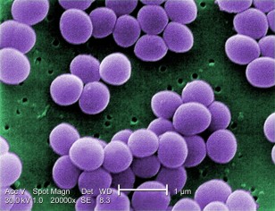 Scanning electron micrograph of Staphylococcus. aureus; false color added. (CDC)