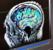 Example of an fMRI scan used for targeting the device implantation location. (Caltech)