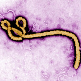 Colorized transmission electron micrograph (TEM) revealed some of the ultrastructural morphology displayed by an Ebola virus virion. (CDC/Frederick Murphy)
