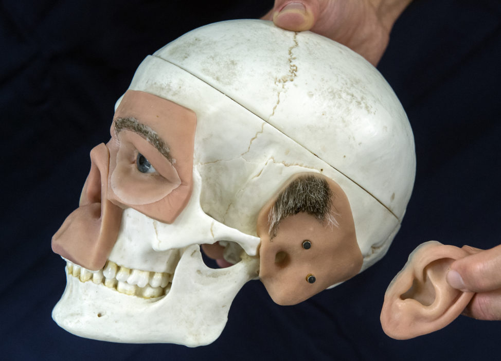 An exhibitor shows a skull model with 3D modelled prostheses during the FabCon 3.D and Rapid.Tech international fairs in Erfurt, Germany on June 20, 2017. (AP)