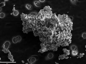 Cometary-type interplanetary dust particle, magnified by an electron microscope. (Hope Ishii, UH Mānoa)