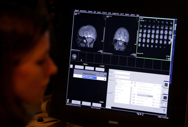 FILE - A research Assistant looks over brain scans of a six-year-old at Georgetown University Hospital in Washington as part of an effort to understand what goes wrong inside the brains of children with autism. (AP)