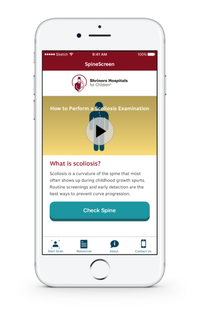 A screenshot from SpineScreen that helps users understand scoliosis and how to check for its symptoms. (Shriners Hospitals for Children)